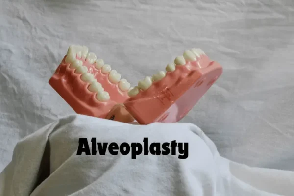 Alveoplasty